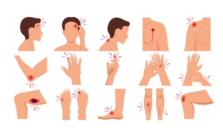 Yaranın Oluşum Nedenleri